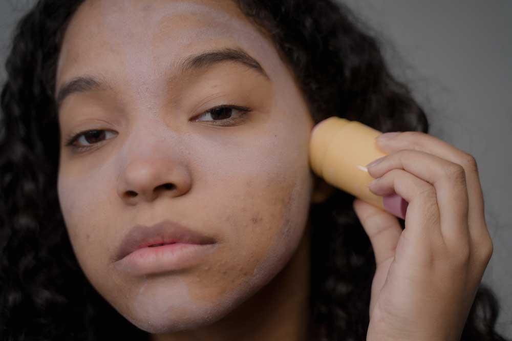 Productos faciales para tratar el acné